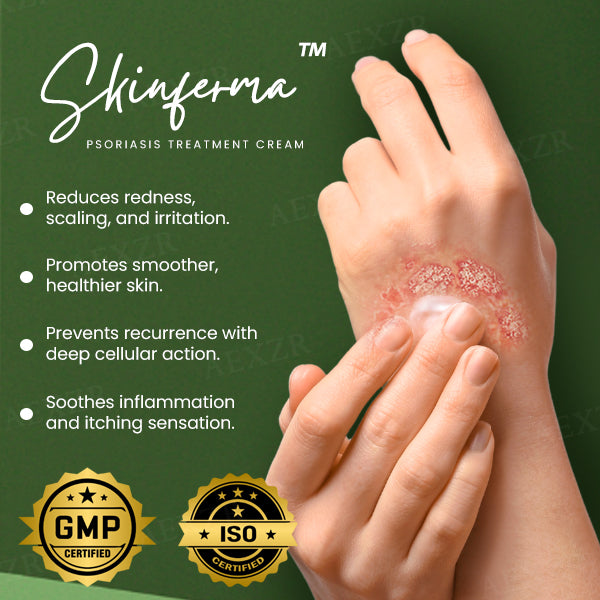 Skinferma™ Psoriasis Treatment Cream - Pure Natural Ingredients